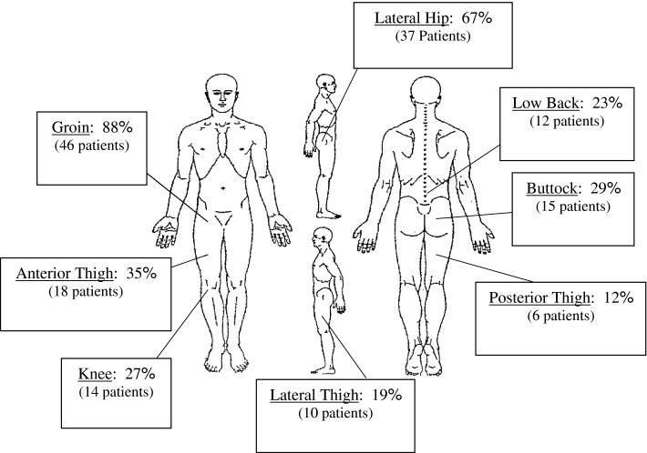 Sports Hernias (Athletic Pubalgia)