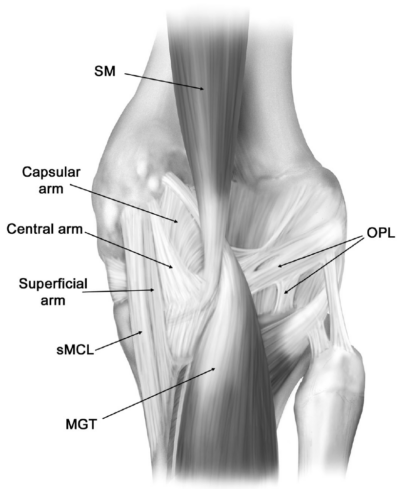 Posteromedial Corner (PMC) of the Knee Injuries - Frisco, TX - Knee ...